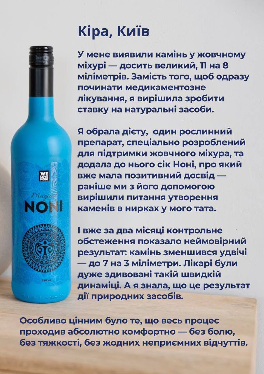 Камінь у жовчному міхурі